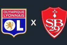Lyon x Brest